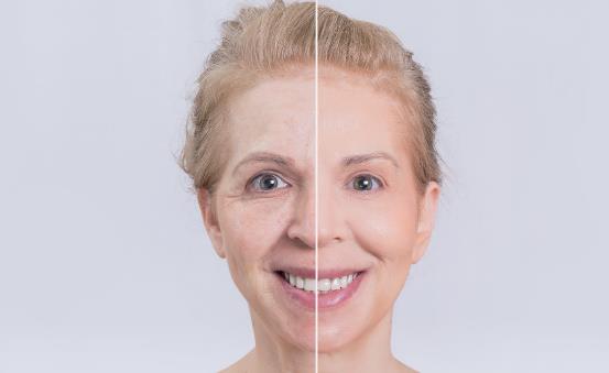 眼角皺紋長(zhǎng)出來(lái)了 6個(gè)方法能祛除