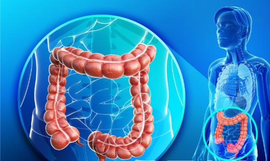腸癌的早期癥狀是隱蔽的 這幾類食物最容易招來腸癌