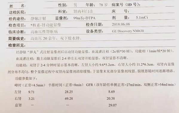 青島靜康醫(yī)院案例:明明是重度腎衰,血肌酐卻正常!化驗(yàn)單會說謊嗎?