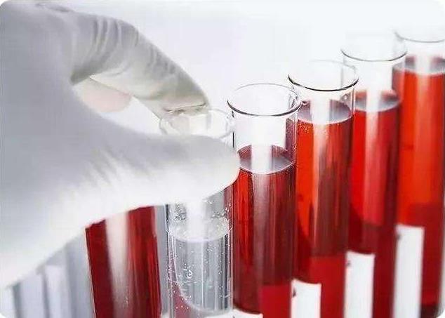 青島靜康醫(yī)院案例:明明是重度腎衰,血肌酐卻正常!化驗(yàn)單會說謊嗎?