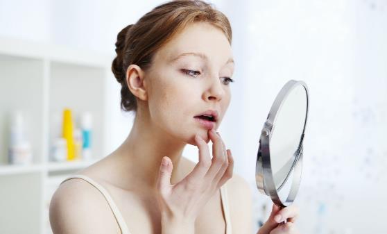 下巴長痘痘怎么辦 祛痘小竅門