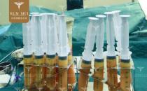 北京潤美玉之光張紅芳丨自體脂肪精度填充，在細節(jié)上提升效果