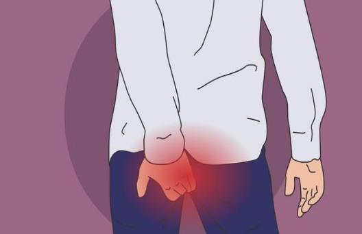 南充市東大肛腸醫院技術好嗎 告訴你痔瘡如何防治