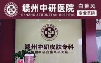 贛州白癜風(fēng)醫(yī)院離火車站多遠 疫情期間白癜風(fēng)患者怎么提高免疫力