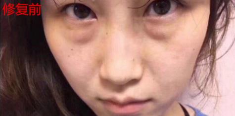 衛婭日記：我一直都以為眼袋對我的影響只是美觀，直到我了解了以后……