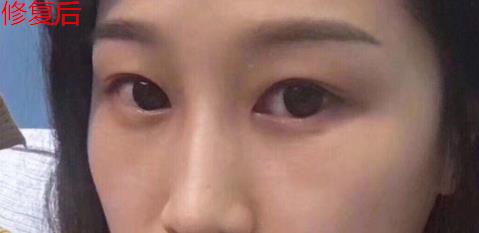 衛婭日記：我一直都以為眼袋對我的影響只是美觀，直到我了解了以后……