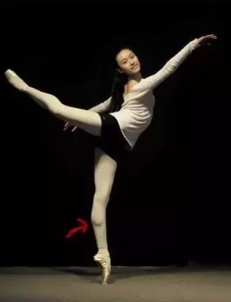 上海麗質(zhì)美學(xué)整形門診部做瘦小腿價(jià)格貴嗎?肌肉小腿太難減怎么辦