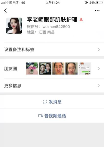 君雅筆記:眼袋過重,就會顯得比真實年齡大,要如何修復眼袋呢?