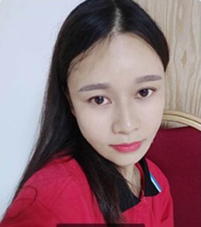 君雅筆記:眼袋過重,就會顯得比真實年齡大,要如何修復眼袋呢?