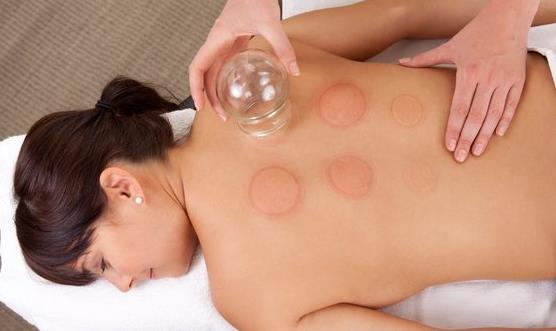 拔火罐減肥能減肥嗎 拔火罐減肥有哪些注意事項