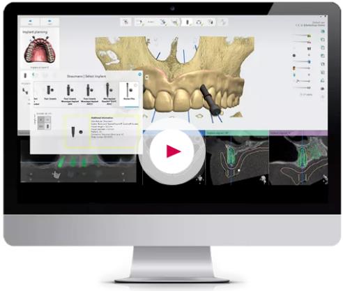 中家醫口腔全民愛牙公益行動:德國智能種植牙更靠譜