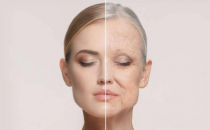 ?肌美人蔓越莓膠原蛋白肽，阻擊自然老化，恢復(fù)年輕體態(tài)