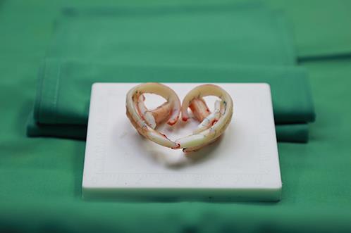 為愛圓夢(mèng)給耳朵一次新生——記一場(chǎng)特殊的直播