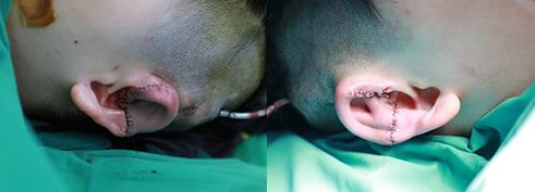 為愛圓夢(mèng)給耳朵一次新生——記一場(chǎng)特殊的直播