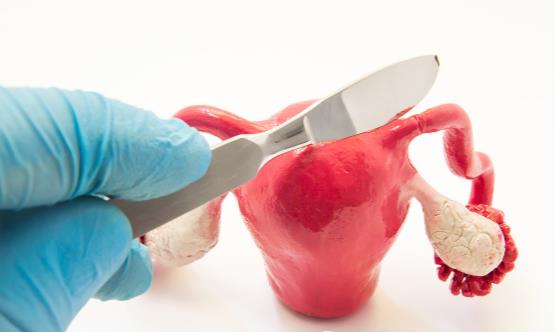 什么原因會引起宮外孕 這6個問題教你預防宮外孕