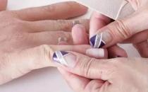 ?甲溝炎竟是自己作出來的 甲溝炎預(yù)防成了關(guān)鍵