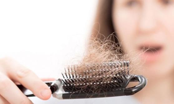 導致女性掉發的6個原因