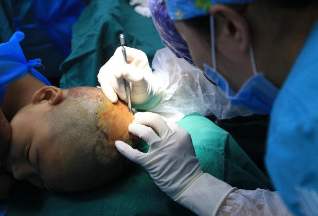 廣州青逸植發(fā),這樣做真的可以防止脫發(fā)嗎?