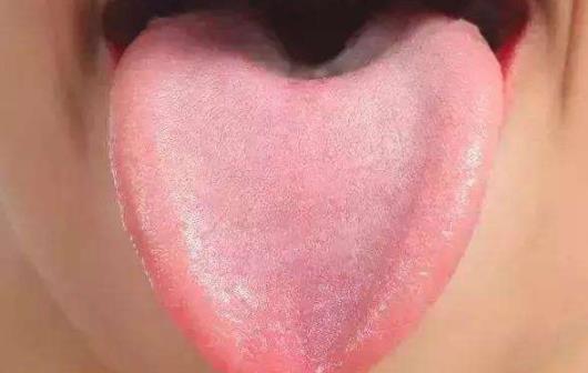 血瘀會影響月經嗎 血瘀會導致發胖嗎